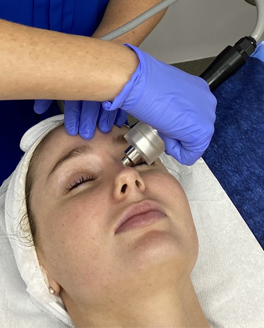 Microdermabrasion National Skin Cancer Centres